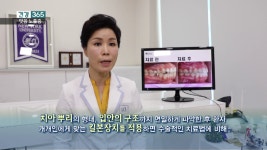 [KNN 건강365] 2019.08.12 (월) 거미스마일 교정 :: 부산교정치과/덕천교정치과/수영교정치과 - kakaoTV [KNN 건강365] 2019.08.12 (월)... 