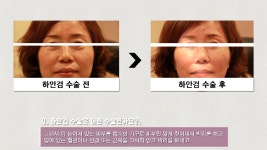 [엔비유의원] 이젠 생기있는 눈으로 변신할 때 - kakaoTV [엔비유의원] 이젠 생기있는 눈으로 변신할 때