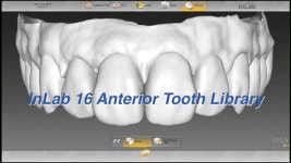 [덴탈톡하자]임영한.Tooth Library & Tooth Design - kakaoTV [덴탈톡하자]임영한.Tooth Library & Tooth Design
