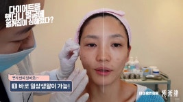 아미율 볼륨윤곽리프팅! 무조건 땡기기만 하는 리프팅이 아닌 채워서... kakaoTV 아미율 볼륨윤곽리프팅!  무조건 땡기기만 하는 리프팅이 아닌... 