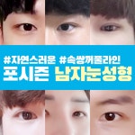 남자쌍수 포시즌성형외과 - kakaoTV 남자쌍수 포시즌성형외과