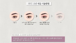 [엔비유의원] 이마의 힘으로 눈을 뜨고 있다면? - kakaoTV [엔비유의원] 이마의 힘으로 눈을 뜨고 있다면?