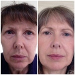 NATURAL SKIN CARE ANTI-AGING TRIAL SET | Trade Me NATURAL SKIN CARE ANTI-AGING TRIAL SET