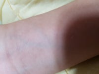 오버워치 인벤 : 저는 어린이집 때 혈액형 뭐있는지 몰라서 - 오버워치 인벤 자유게시판 오버워치 인벤 : 저는 어린이집 때 혈액형 뭐있는지 몰라서