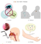 복약정보 : 전남대학교병원