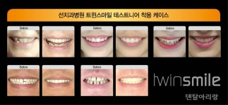 인쇄하기