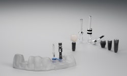 블라인드 | 디오 뉴스