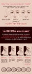 비율에 맞는 콧대+코끝성형 - 라이크성형외과의원 | 병원약국검색어플, 굿닥
