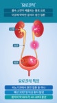 환자 2명 중 1명 재발하는 ‘요로결석’ 상태에 따른 치료 & 예방법 - 힐팁 환자 2명 중 1명 재발하는 ‘요로결석’ 상태에 따른 치료 & 예방법