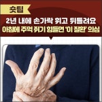 [숏팁] 2년 내에 손가락 휘고 뒤틀려요 - 힐팁 [숏팁] 2년 내에 손가락 휘고 뒤틀려요