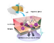 부작용 무서운 조영제 없이 치매 원인 물질 모니터링 | 한국과학기술연구원