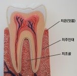 ‘잇몸이 붓고 양치할 때 피가 나요’ [이엠디] ‘잇몸이 붓고 양치할 때 피가 나요’
