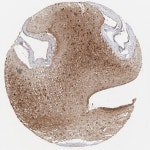 Tissue expression of SPP1 - Staining in caudate - The Human Protein Atlas
