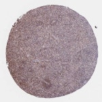 Tissue expression of LAS1L - Staining in spleen - The Human Protein Atlas