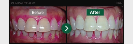 POOM | 약국 계면활성제 없는 메디테라 잇몸 치약 120g, 12개 약국 계면활성제 없는 메디테라 잇몸 치약 120g, 12개