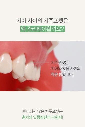 칫솔 > 탄모칫솔 10개 부드러운 미세모 치과 어금니 잇몸 임산부 작은헤드 치석제거 구취 | 오늘의집 쇼핑 탄모칫솔 10개 부드러운 미세모 치과...