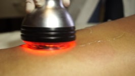 A Woman Getting Cavitation Theraphy 스톡 동영상 비디오(100% 로열티 프리) 10099352 | Shutterstock