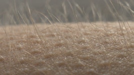 Goosebumps Close Up. Hair On 스톡 동영상 비디오(100% 로열티 프리) 1031071640 | Shutterstock