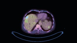 Pet Ct ( Positron Emission 스톡 동영상 비디오(100% 로열티 프리) 1068713939 | Shutterstock