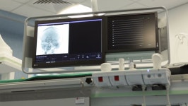 New Neurosurgery Room in a 스톡 동영상 비디오(100% 로열티 프리) 23473123 | Shutterstock