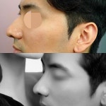 오늘성형외과의원 위치 · 진료시간 · 후기 확인하기