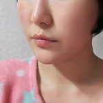 비엔성형외과의원 위치 · 진료시간 · 후기 확인하기