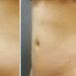 강남조은눈안과의원 위치 · 진료시간 · 후기 확인하기