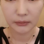 유캔비성형외과의원 위치 · 진료시간 · 후기 확인하기