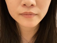 하이봄성형외과의원 위치 · 진료시간 · 후기 확인하기