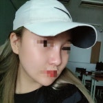 오페라성형외과의원 위치 · 진료시간 · 후기 확인하기