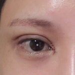 팝성형외과의원 위치 · 진료시간 · 후기 확인하기