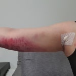 하이라이트의원 위치 · 진료시간 · 후기 확인하기