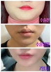 아몬드성형외과의원 위치 · 진료시간 · 후기 확인하기
