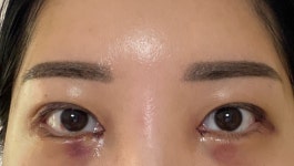마이티성형외과의원 위치 · 진료시간 · 후기 확인하기 | 굿닥