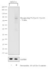                     Phospho-Zap-70 (Tyr315, Tyr319) Antibody (700177)... 