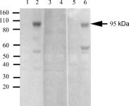                                                                                         Anti-IR/IGF1R Antibodies | Invitrogen... 