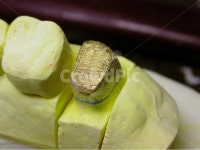 치과, 보철, 치과기공, 기공, 치과기공사, 사진,이미지,일러스트,캘리그라피 - SeeOn작가 크라우드픽 - 저작권 걱정 없는 상업용 이미지