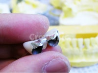 치과, 의료, 앞니, 치과기공사, 기공사, 사진,이미지,일러스트,캘리그라피 - SeeOn작가 크라우드픽 - 저작권 걱정 없는 상업용 이미지