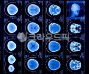 xray, 엑스레이, medicalimagingxrayfilm, 의료영상x선필름, ctscan, 사진,이미지,일러스트,캘리그라피 - Nepoto1작가 크라우드픽... 