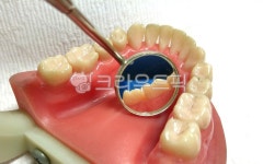 치과, 덴탈, 치아, 이빨, 덴티폼, 사진,이미지,일러스트,캘리그라피 - SeeOn작가 크라우드픽 - 저작권 걱정 없는 상업용 이미지