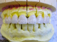 치과, 의료, 치과기공사, 앞니, 포세라인, 사진,이미지,일러스트,캘리그라피 - SeeOn작가 크라우드픽 - 저작권 걱정 없는 상업용 이미지