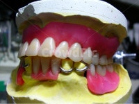 치과, 의료, 틀니, 치과기공사, 기공사, 사진,이미지,일러스트,캘리그라피 - SeeOn작가 크라우드픽 - 저작권 걱정 없는 상업용 이미지