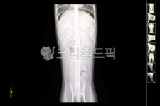 엑스레이, 뼈, 동물병원, 개, 갈비뼈, 사진,이미지,일러스트,캘리그라피 - 횽횽작가 크라우드픽 - 저작권 걱정 없는 상업용 이미지