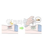 한의학, 한의원, 치료, 시술, 기전, 사진,이미지,일러스트,캘리그라피 - Nchuccida작가 크라우드픽 - 저작권 걱정 없는 상업용 이미지