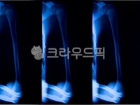 xray, 엑스레이, medicalimagingxrayfilm, 의료영상x선필름, ctscan, 사진,이미지,일러스트,캘리그라피 - Nepoto1작가 크라우드픽... 