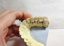 치과, 보철, 덴탈, dental, 치과기공사, 사진,이미지,일러스트,캘리그라피 - SeeOn작가 크라우드픽 - 저작권 걱정 없는 상업용 이미지