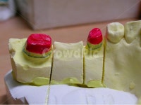 치과, 의료, 보철, 치과기공사, 석고, 사진,이미지,일러스트,캘리그라피 - SeeOn작가 크라우드픽 - 저작권 걱정 없는 상업용 이미지