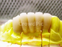 치과, 의료, 보철, 치과기공사, 성형, 사진,이미지,일러스트,캘리그라피 - SeeOn작가 크라우드픽 - 저작권 걱정 없는 상업용 이미지