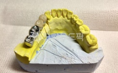 치과, 덴탈, 보철, 치과기공사, dental, 사진,이미지,일러스트,캘리그라피 - SeeOn작가 크라우드픽 - 저작권 걱정 없는 상업용 이미지