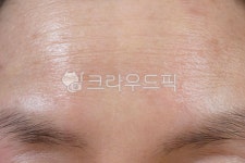 이마, 주름, 주름살, 피부, 노화, 사진,이미지,일러스트,캘리그라피 - wowbee작가 크라우드픽 - 저작권 걱정 없는 상업용 이미지
